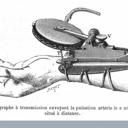 Figure of a sphygmograph, used to chart the pulse